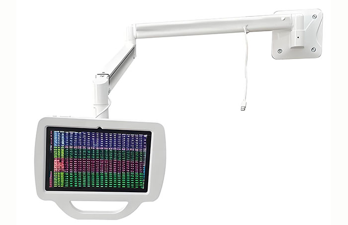 鋁型材定制開(kāi)模病床支架機(jī)械手鋁型材